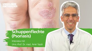 Schuppenflechte Psoriasis Prof Yazdi steht Rede und Antwort [upl. by Akelam]