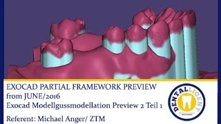 EXOCAD TUTORIAL 2016Exocad Modellgussmodellation Preview 2 Teil 1 PARTIAL FRAMEWORK [upl. by Cliffes558]