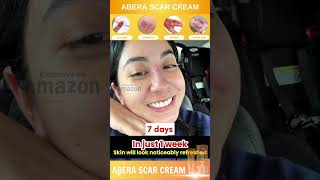 Effective Skin Repair with Abera Cream [upl. by Aelber]