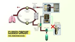 Anesthesia Machine Fundamentals [upl. by Lanor]