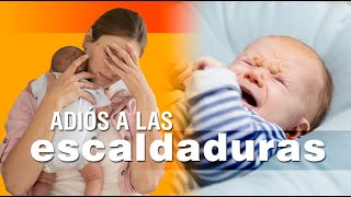 Las escaldaduras en los bebés  síntomas causas y soluciones [upl. by Arlena]