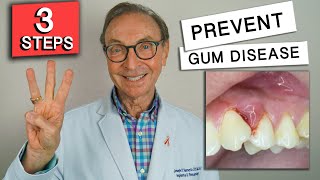 3 Easy Ways to Prevent Gum Disease at Home [upl. by Eannej]