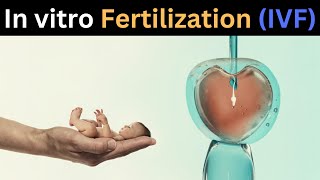 How in vitro fertilization IVF works  Nassim Assefi and Brian A Levine [upl. by Llenreb]