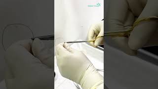 Biopsy for histopathology  Dhaka Dermatology Institute  LaserTreat [upl. by Eceirtal]