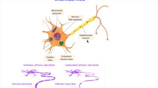 ALS pathology amp pathogenesis [upl. by Dira]