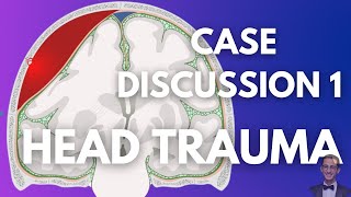 Case Discussion Neurosurgery  Head Trauma  Case 1 [upl. by Dnalyram322]