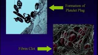 Part 2  Everything You Wanted to Know About Blood Clots  Stop the Clot Forum [upl. by Siloa398]