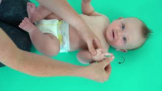 Baby Development  Erbs Palsy  Hand Massage [upl. by Cristionna325]