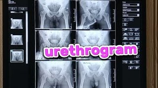 How i prepare urethrogram x ray  x ray urethrogram taking and filming [upl. by Nomelc]