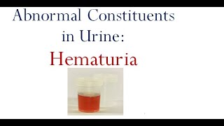 Hematuria [upl. by Ahsinrats]