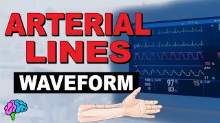 The Arterial Line Waveform EXPLAINED [upl. by Dorotea567]