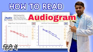 How to read Audiogram  Explained in Hindi  सुनाई की जाँच Audiometry test रिपोर्ट को कैसे पढ़ें [upl. by Nele446]