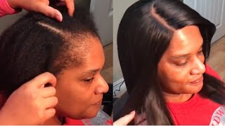 Natural sew in AFTER braids damage your edges [upl. by Yarised894]