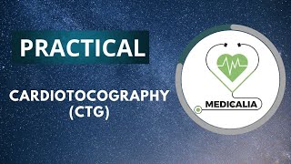 Cardiotocography  CTG   part 2 [upl. by Htiduj607]