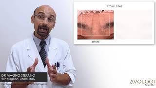 Avologi Eneo Totale review by Doctor Stefano Magno [upl. by Hajin]