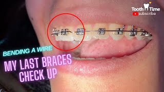 My Last Braces Checkup  Bending orthodontic wire  Tooth Time Family Dentistry New Braunfels [upl. by Ready]