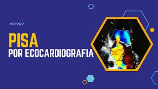 ✅Método PISA en Ecocardiografia [upl. by Ati]