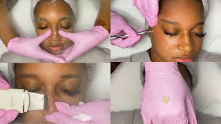 Summer Glow Facial w Microdermabrasion  GlamByLiaLeigh [upl. by Sivle165]