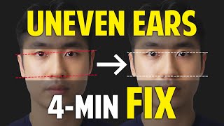 Fix Uneven Ears｜Facial Asymmetry Correction｜Balancing Exercises [upl. by Nylrehs445]