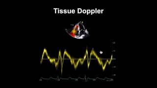 Echocardiography Essentials Evaluating right ventricular size and function [upl. by Akerehs128]