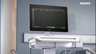 Philips Cardiac Workstation — Tap the power of connected cardiography [upl. by Gurl]