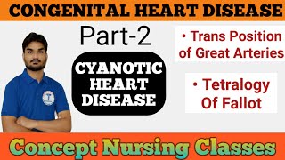 Congenital Heart Disease Part2 Cyanotic Heart Disease Tetralogy Of Fallot [upl. by Edecrem414]