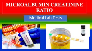 MICROALBUMIN CREATININE RATIO TEST  Lab Tests  What is   Uses  Need  Preparation  Results [upl. by Netty]