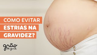 O QUE VOCÊ PRECISA SABER SOBRE ESTRIAS NA GRAVIDEZ [upl. by Nodanrb180]