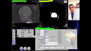 TOMOGRAFÍA MULTIDETECTOR CRANEO SC SIEMENS SOMATOM 6 CORTES [upl. by Ainoval]