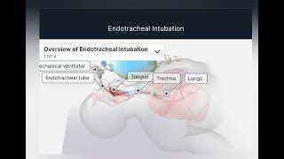 Endotracheal intubation hayatayoz [upl. by Appledorf]