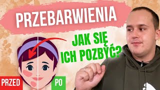 Wykład kosmetyczny  lekcja nr 4  Przebarwienia składniki aktywne trądzik piękna skóra i naprawa [upl. by Blessington18]