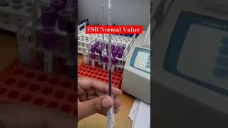 ESR Erythrocyte Sedimentation Rate🩸 Infection blood  ESR infection paramedical [upl. by Ocire]