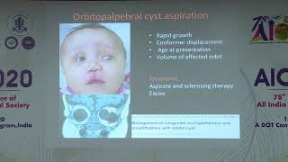 AIOC2020 IC238 T5 Dr Savari Desai Congenital Anophthalmos Microphthalmos Recent Concepts [upl. by Easlehc]