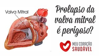 Tenho Prolapso da Valva Mitral Devo me preocupar [upl. by Anaillil]