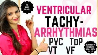 Ventricular TachyArrhythmias PVC VT TdP VFib USMLE STEPs 1 2 amp 3 [upl. by Adleremse590]