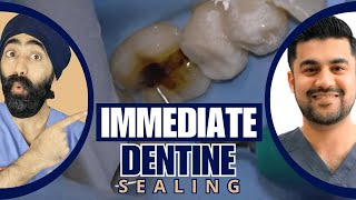 Immediate Dentine Sealing Tutorial Part 1  PDP173 [upl. by Maggs]