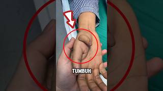 Segera lari jika jarimu tumbuh lagi‼️😱 [upl. by Trisa127]