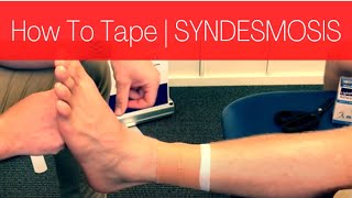 HOW TO TAPE A SYNDESMOSIS HIGH ANKLE SPRAIN [upl. by Enidlarej]