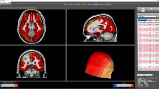 Intro NeuroNavigator NG 3 0 2 [upl. by Ahcsim]