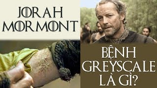 Game of Thrones  JORAH MORMONT MẮC BỆNH GÌ VÀ CÓ CHỮA ĐƯỢC KHÔNG [upl. by Guido]