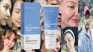 Dermatouch Mild Cleansing Lotion  Honest Review [upl. by Sang929]