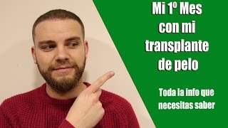 Mi 1º mes con mi trasplante de pelo Información cómo dormir prohibiciones y consejos [upl. by Jobie]