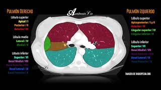 Segmentación pulmonar [upl. by Rollin]