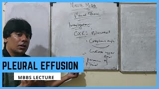 Pleural Effusion  Full Lecture  URDUHINDI  MBBS Lecture [upl. by Ened30]