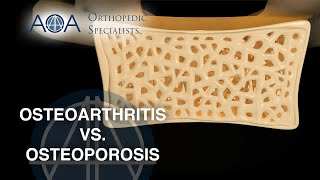 Osteoporosis vs Osteoarthritis [upl. by Odell]