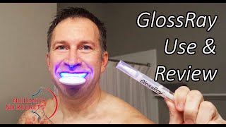 Does TEETH WHITENING WORK By GLOSSRAY Customer AT HOME Teeth Whitening [upl. by Chuah360]