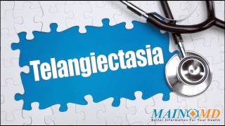 Telangiectasia ¦ Treatment and Symptoms [upl. by Howzell]