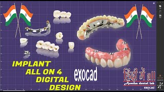 IMPLANT ALL ON 4 DIGITAL DESIGN exocad  Exocad Implant Screw retained All on 4 Tutorial in Galway [upl. by Madella]