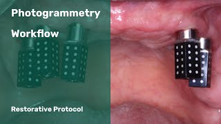 Photogrammetry Restorative Dental Workflow [upl. by Ajnin]