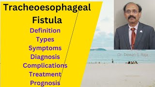 Tracheoesophageal Fistula [upl. by Schulze539]